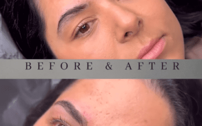 Restorative Brow Treatment