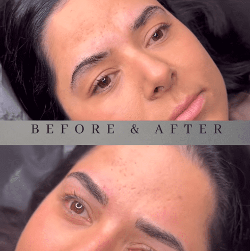 Restorative Brow Treatment